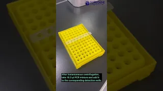 Covid-19 Nucleic acid detection kits(rRT PCR)  by Foregene