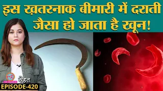 Sickle Cell Anemia यानी ज़िंदगीभर के लिए हो जाती है खून की कमी, ये गलतियां न करें | Sehat ep 420