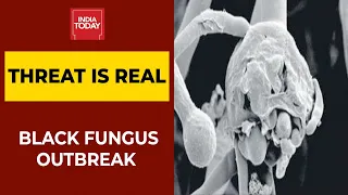 Black Fungus Outbreak In India, It's A Rare But Serious Fungal Infection