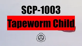 SCP-1003 | Keter | Tapeworm Child