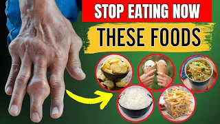 Don't Eat! 15 Most Dangerous Foods For Arthritis That You Often Overlook (not what you think)
