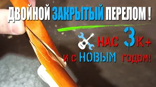 Двойной закрытый перелом + 3000 + Новый год