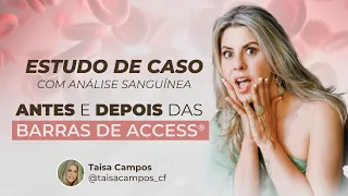 Estudo de caso - Antes e Depois das Barras de Access com Taisa Campos