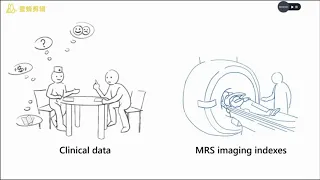 MRS risk prediction model for post-stroke depression (PSD) - Video abstract [ID 245129]