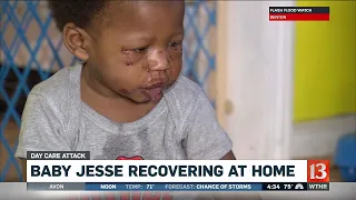 1-year-old recovering after day care attack