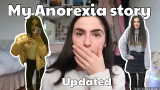 My eating disorder story: Anorexia Nervosa