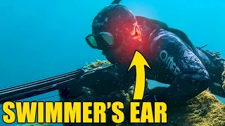 Swimmer's Ear [Otitis Externa] Prevention - DIY Solution For Divers