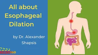 Esophageal Dilation at Atlantic Gastroenterology - Dr. Alexander Shapsis