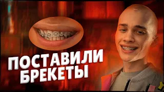 Дане Милохину поставили БРЕКЕТЫ! / ШОК! / КАК ОН ВЫГЛЯДИТ?