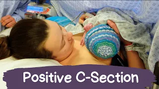 My Birth Story | Positive Gentle C-section