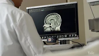 New Portable MRI Might Help Save Your Life After a Stroke