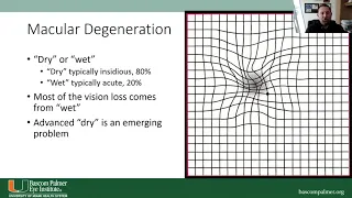Aging Well: Aging of the Eyes- Macular Degeneration and Cataracts