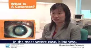 What is Cataract? - SNEC (Singapore National Eye Centre)