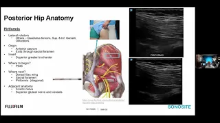 Webinar: Examining Hip Anatomy and Structure with POCUS - Posterior Hip