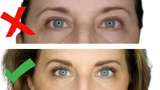 How to Have Younger Looking Eyes Over 50