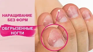 Спасаем ОБКУСАННЫЕ ногти |  Наращивание полигелем на Ногти Грызуна