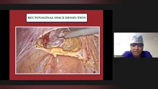 "Pelvic Anatomy for endoscopic surgeons"By Dr Shailesh Puntambekar (DGF eCME on 5th April 21)