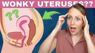 What is a retroverted uterus??