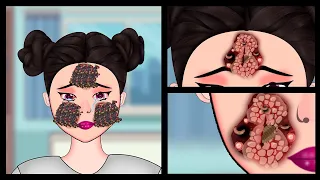 ASMR Ticks And Maggots Infected Face Treatment Animation | JINJJA 진짜 ASMR