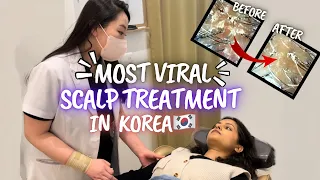 ASMR The Most Viral Scalp Treatment in Korea | Korean Hair Spa | Ear Therapy | Indian In Korea🇰🇷