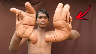 10 People With The Largest Body Parts In The World