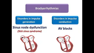 ECG course: Classification of Bradyarrhythmias, Dr. Sherif Altoukhy