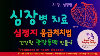 심장병 31강. 심장 질환치료 심정지 응급처치 방법 건강한 관상동맥 만들기. Treatment of heart disease. First aid for cardiac arrest.