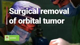 Surgical removal of orbital tumor