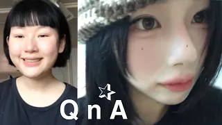 꿘나 어캐했노 (all 성형 QnA,나의성형이야기)