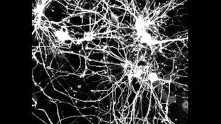 Neuron time lapse video