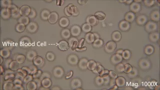 Red blood cells under the microscope, hypo and hypertonic solutions