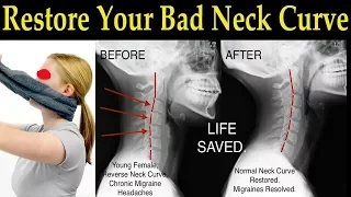Restore Your Bad Neck Curve With a Simple Towel - Dr. Alan Mandell, D.C.