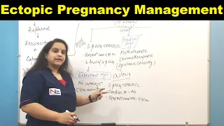 Management of Ectopic Pregnancy | Nursing Lecture