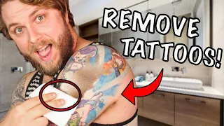 3 Ways To COMPLETELY Remove UNWANTED Tattoos That You Regret!