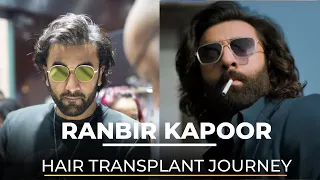 Ranbir Kapoor’s Hair Transplant Journey | Dr Nivedita dadu