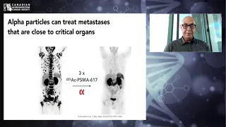 Future of Nuclear Medicine in Treatment of NETs (Actinium 225) - Dr. Philip Cohen (Nuclear Medicine)