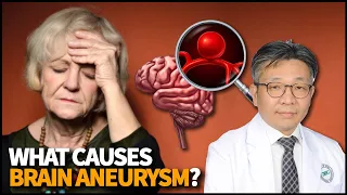 What is Brain Aneurysm? What causes it? How is it diagnosed and treated?