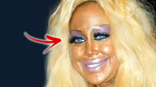 Celebrities Who Destroyed Their Careers With Plastic Surgery | Marathon