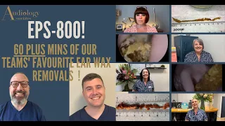 OUR STAFF'S FAVOURITE EAR WAX REMOVALS - EP800