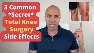 What Your Total Knee Surgeon Never Told You! 3 Common *Secret* Side Effects Of Knee Surgery!