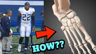 How Derrick Henry Broke His Foot - Doctor Explains Shocking Injury