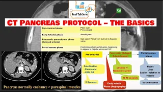 CT scan of the pancreas - pancreas protocol CT scan - Imaging of the pancreas - Edusurg Clinics