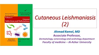 Cutaneous Leishmaniasis 2