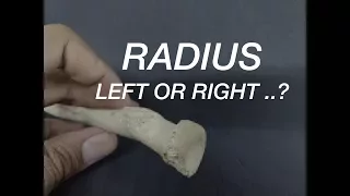 RADIUS - SIDE DETERMINATION