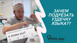 Зачем нужно подрезание уздечки языка? Отвечает стоматолог-хирург