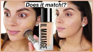 Worth the Hype?? Testing IL Makiage Foundation | Review + Wear Test on ACNE