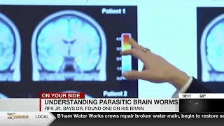 Understanding parasitic brain worms