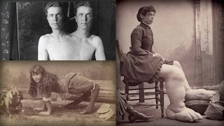 10 Most Shocking Old Freak Acts