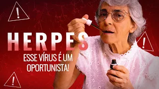 Herpes labial: o que fazer?