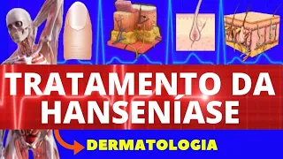 TRATAMENTO DA HANSENÍASE - TRATAMENTO, EFEITOS ADVERSOS E PREVENÇÃO - MEDICAMENTOS PARA HANSENÍASE